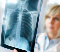 Radiografía de Tórax